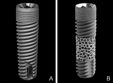  Tantalum: Champion des Implants Médicaux et des Appareils Électroniques de Haute Performance!